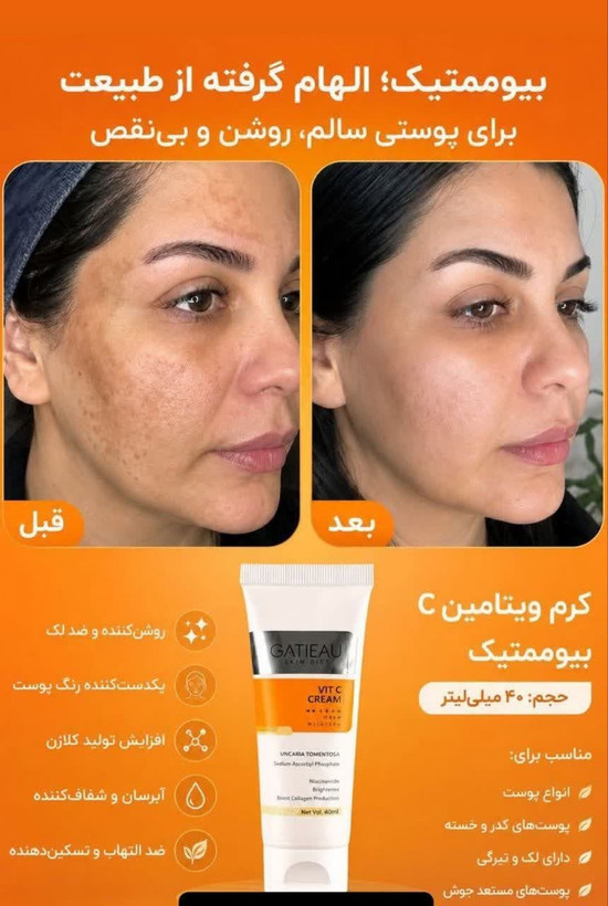 کرم بیوممتیک ویتامین سی گاتیو روشن کننده وضدلک