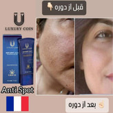 کرم ضد لک Luxury Queenفرانسوی