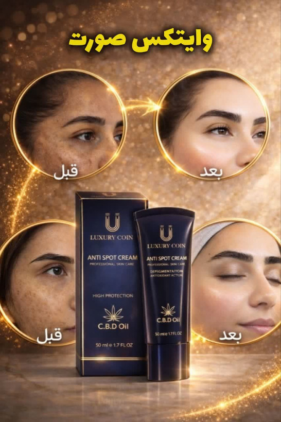 کرم ضد لک Luxury Queenفرانسوی