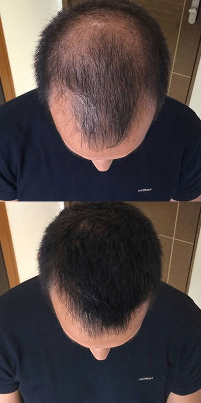 تونیک تقویت کننده وضد ریزش مو هیرفرند