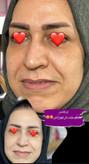 کرم جوانه گندم Vitabella