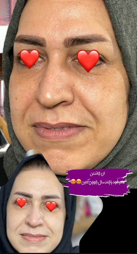 کرم جوانه گندم Vitabella