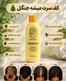 شامپو موی سر حاوی روغن مورینگا 300میل Exonic
